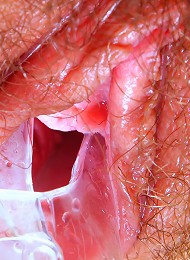 Hairy Blonde Speculums Up her Vagina in Closeup